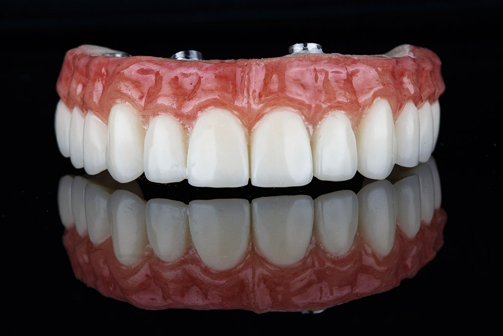 tratamientos-protesis-dentales-recupera-funcionalidad-estetica-bucoodontos